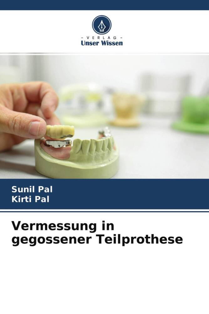 Vermessung in gegossener Teilprothese