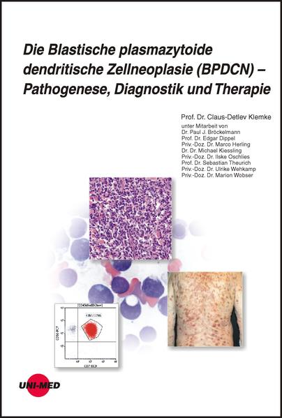 Die Blastische plasmazytoide dendritische Zellneoplasie (BPDCN) - Pathogenese Diagnostik und Therapie