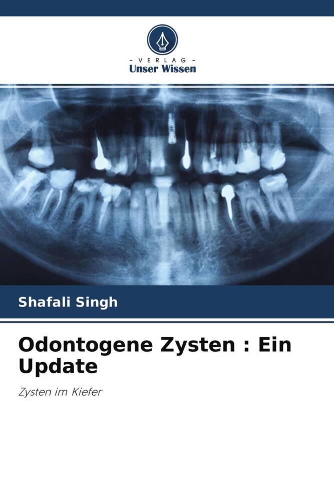 Odontogene Zysten : Ein Update
