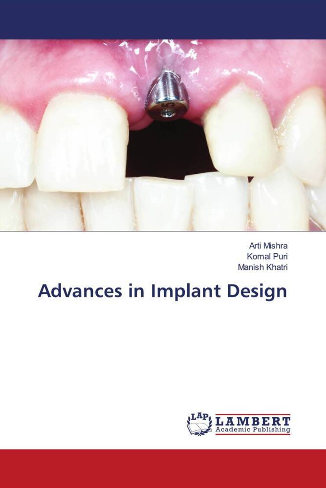 Advances in Implant Design