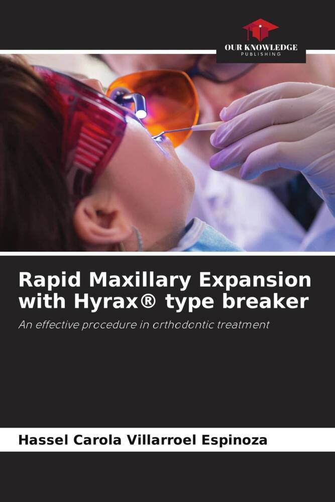 Rapid Maxillary Expansion with Hyrax® type breaker