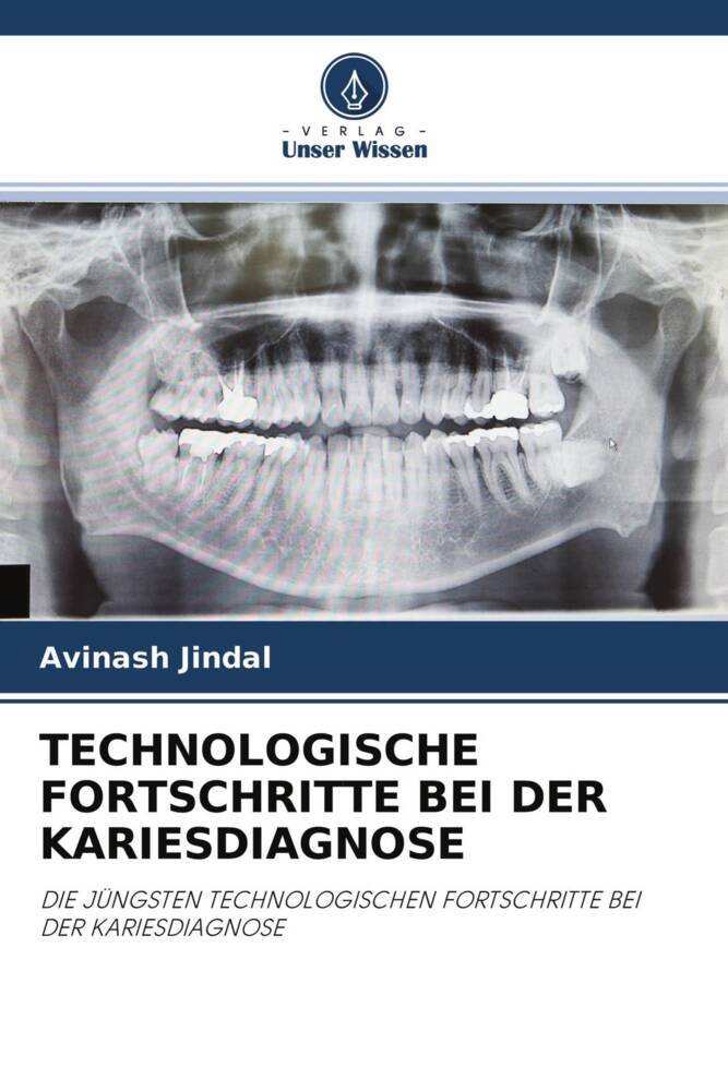 TECHNOLOGISCHE FORTSCHRITTE BEI DER KARIESDIAGNOSE