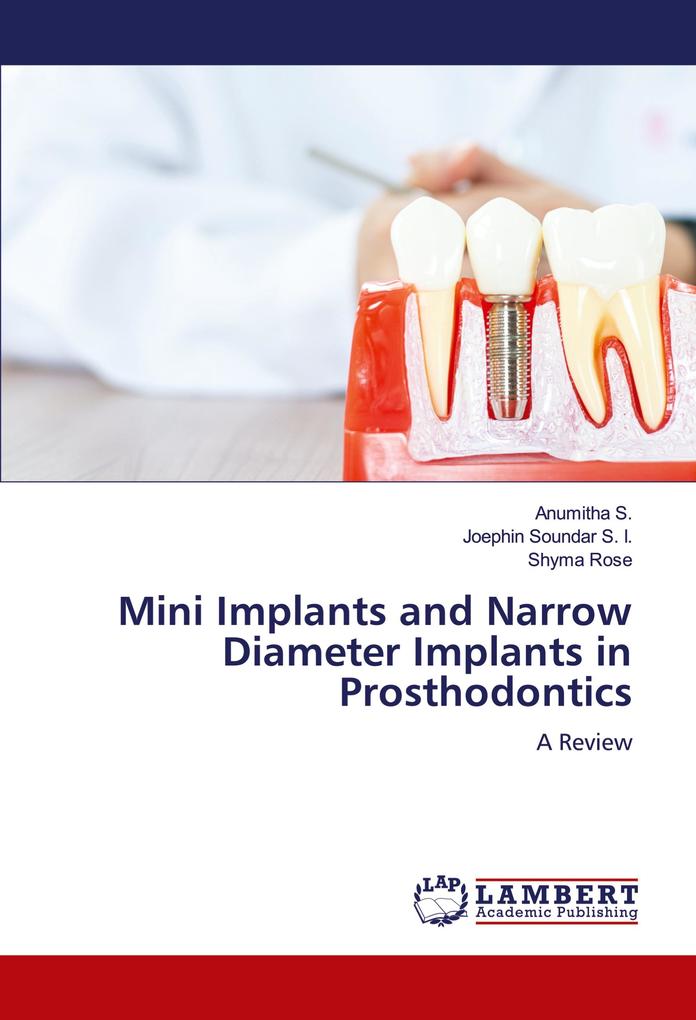 Mini Implants and Narrow Diameter Implants in Prosthodontics