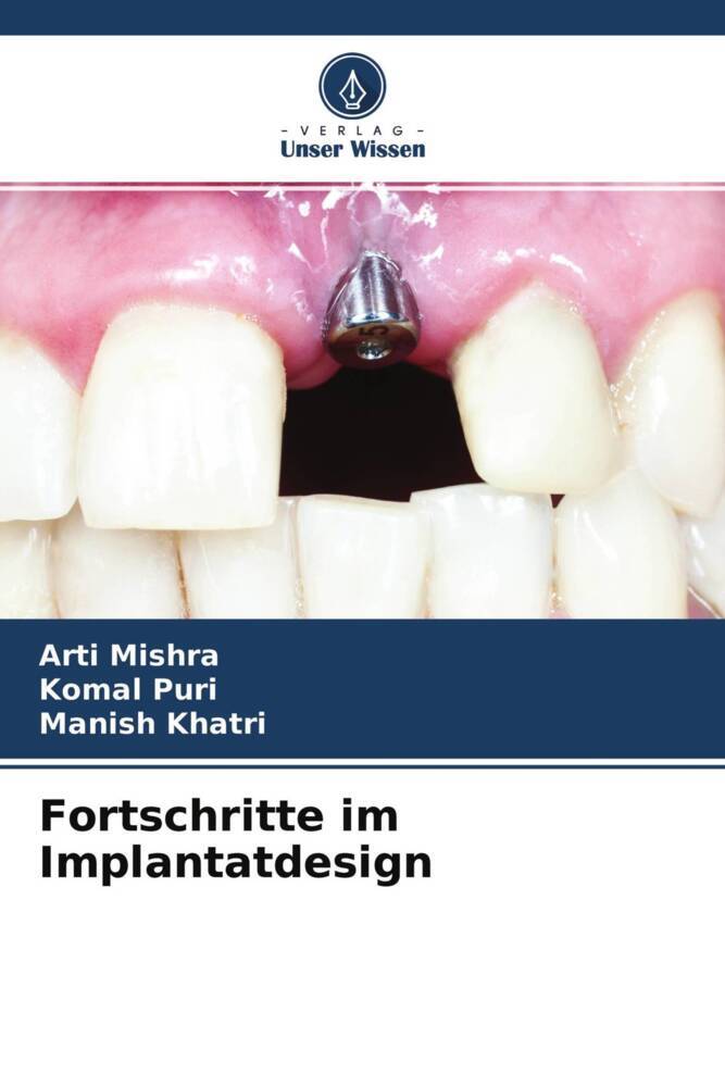 Fortschritte im Implantatdesign