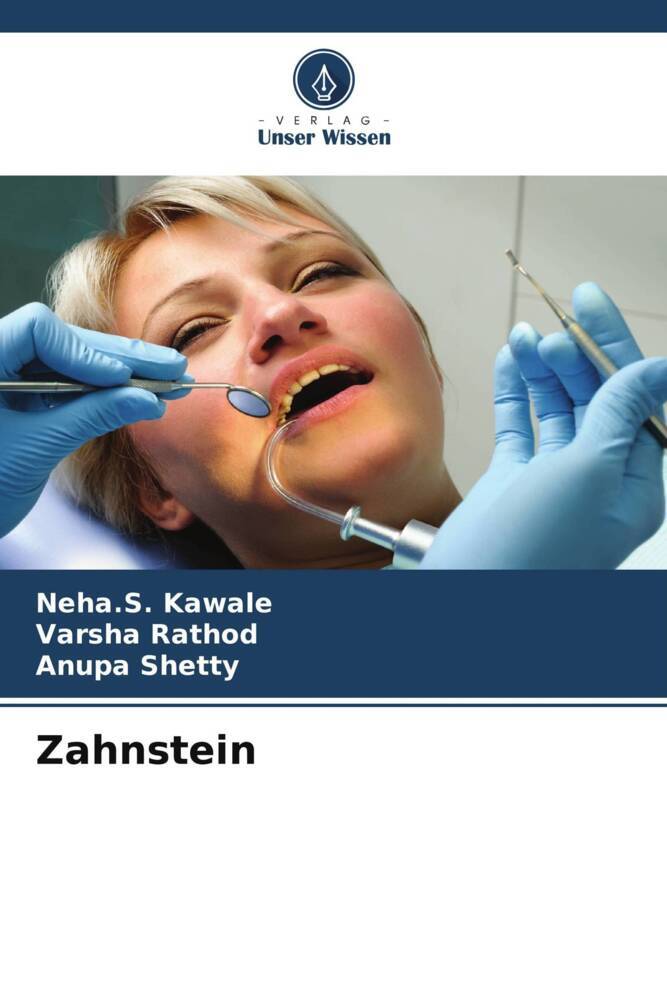 Zahnstein