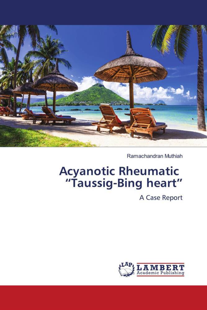 Acyanotic Rheumatic 'Taussig-Bing heart'