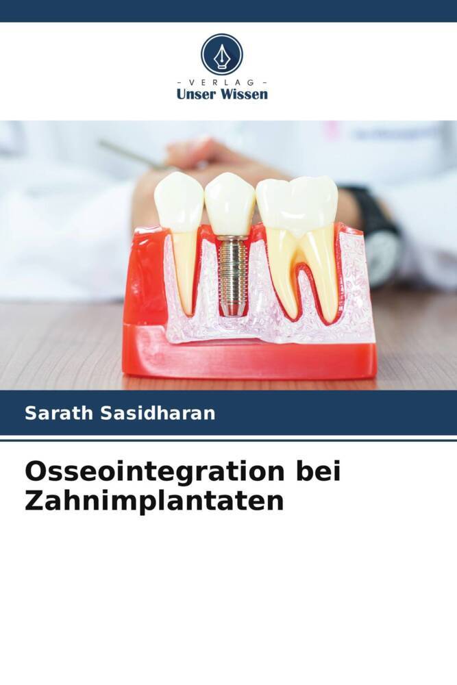 Osseointegration bei Zahnimplantaten
