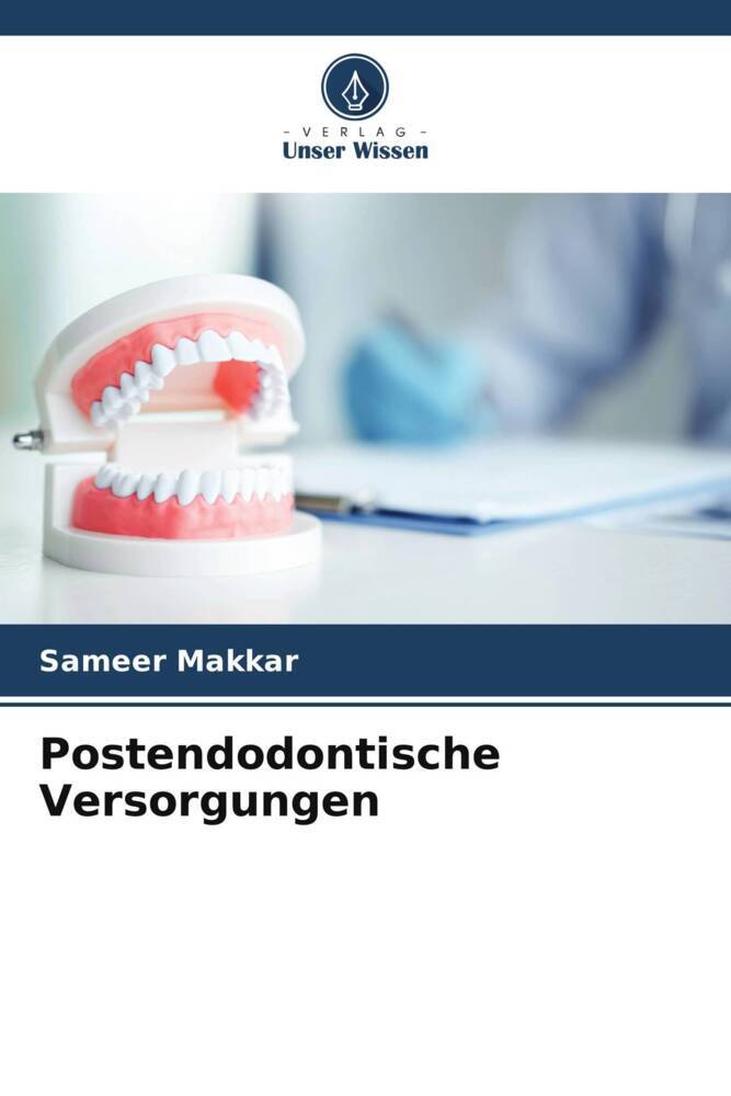 Postendodontische Versorgungen