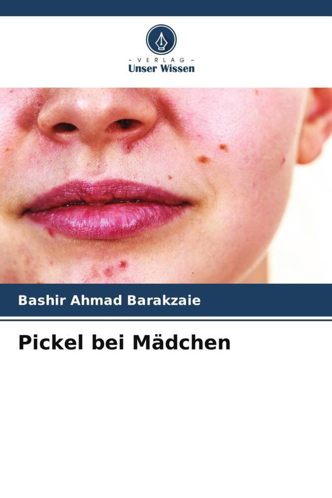 Pickel bei Mädchen