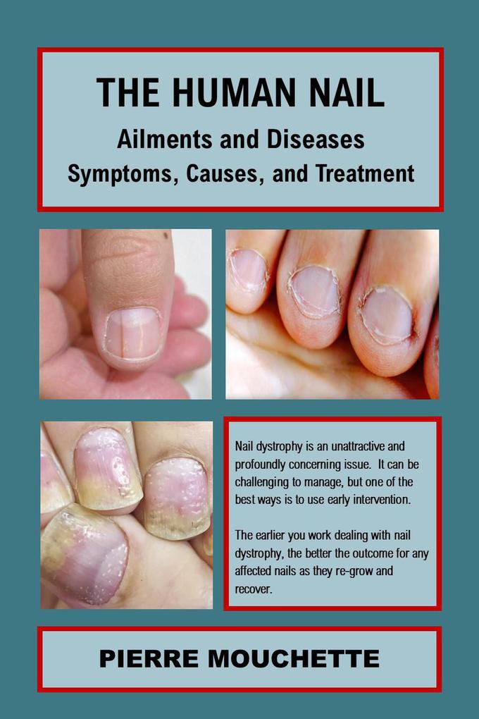 THE HUMAN NAIL - Ailments and Diseases