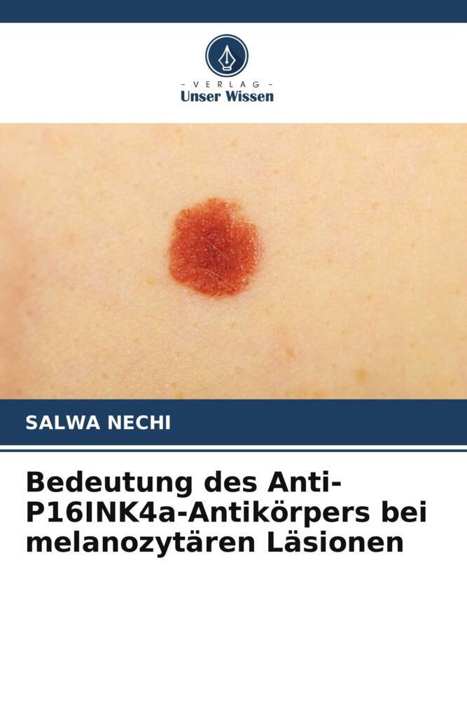 Bedeutung des Anti-P16INK4a-Antikörpers bei melanozytären Läsionen