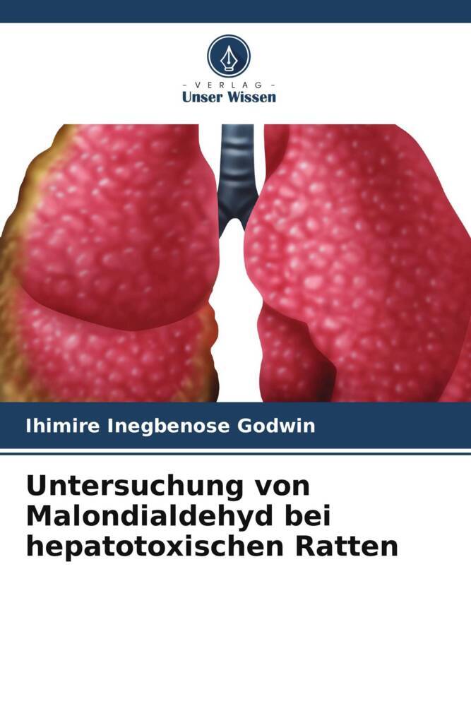Untersuchung von Malondialdehyd bei hepatotoxischen Ratten