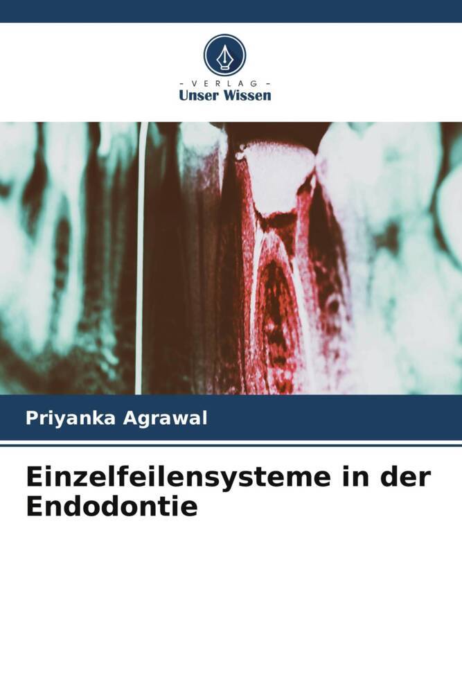 Einzelfeilensysteme in der Endodontie