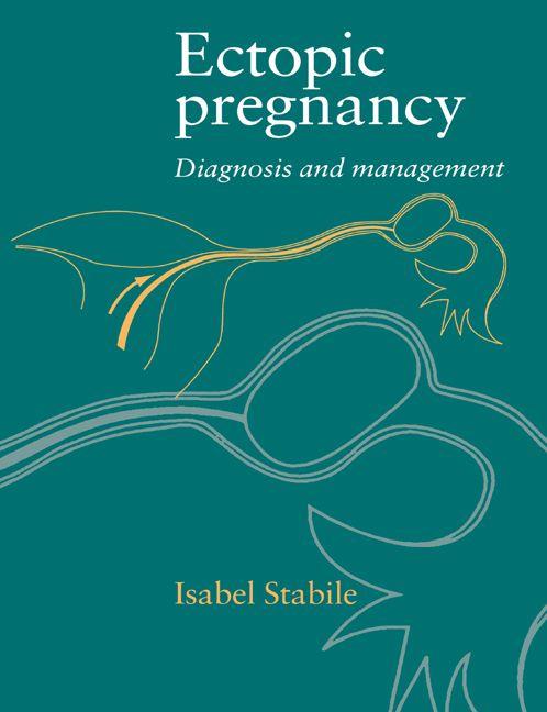 Ectopic Pregnancy