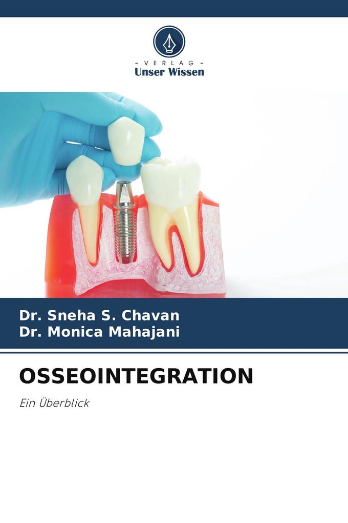 OSSEOINTEGRATION