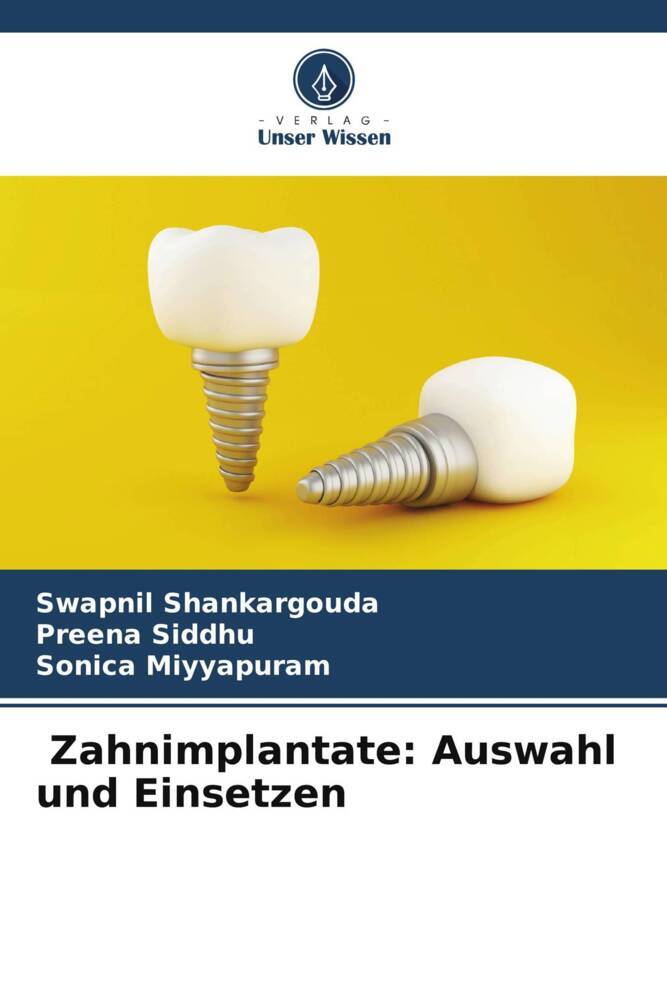 Zahnimplantate: Auswahl und Einsetzen