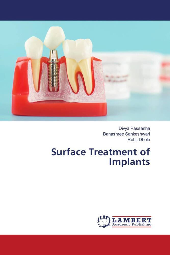 Surface Treatment of Implants