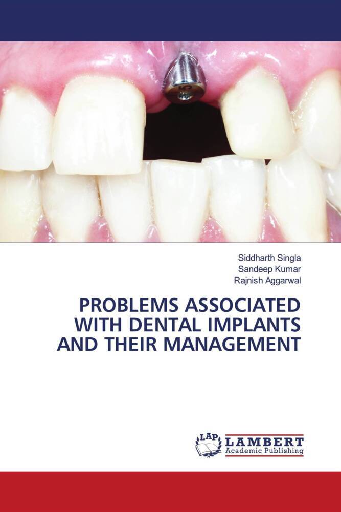 PROBLEMS ASSOCIATED WITH DENTAL IMPLANTS AND THEIR MANAGEMENT