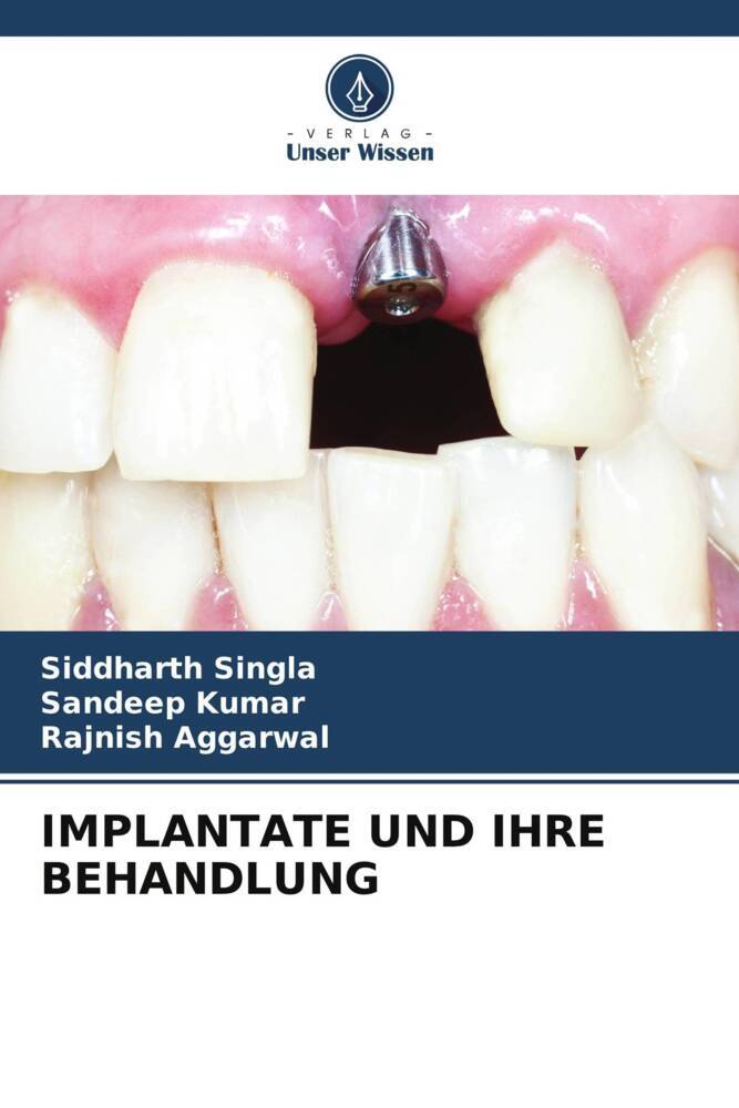 IMPLANTATE UND IHRE BEHANDLUNG