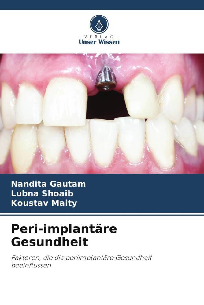 Peri-implantäre Gesundheit
