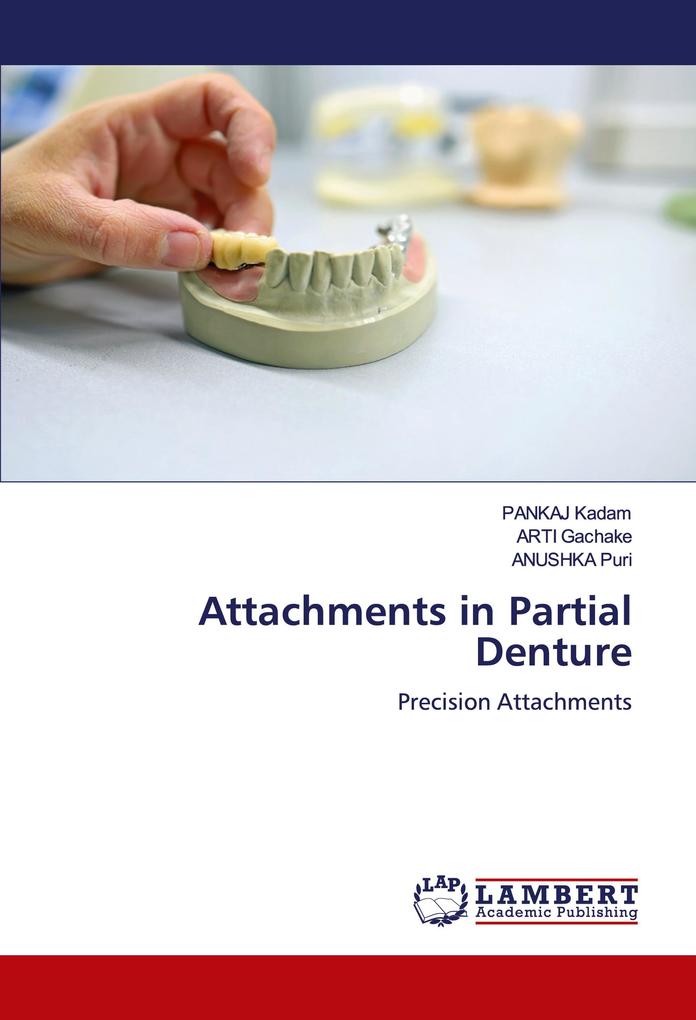 Attachments in Partial Denture