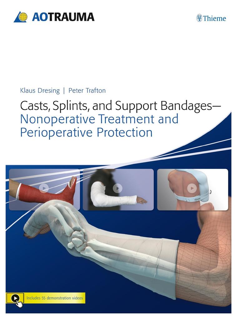 Casts Splints and Support Bandages