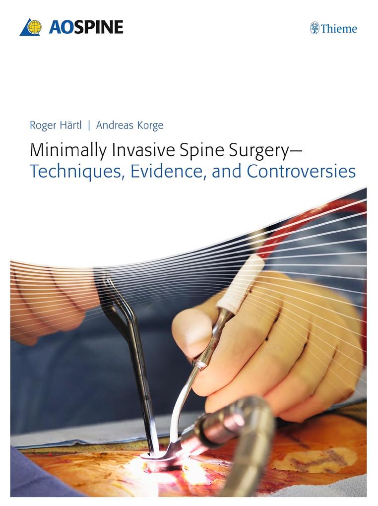 Minimally Invasive Spine Surgery - Techniques Evidence and Controversies