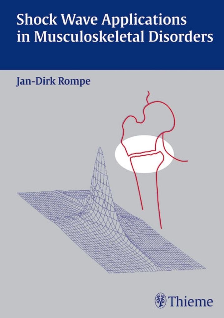 Shock Wave Applications in Musculoskeletal Disorders