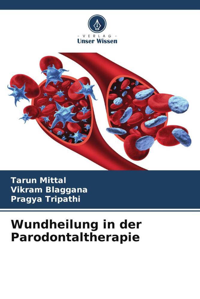 Wundheilung in der Parodontaltherapie
