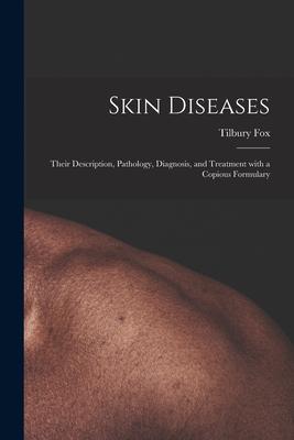 Skin Diseases [electronic Resource]: Their Description Pathology Diagnosis and Treatment With a Copious Formulary