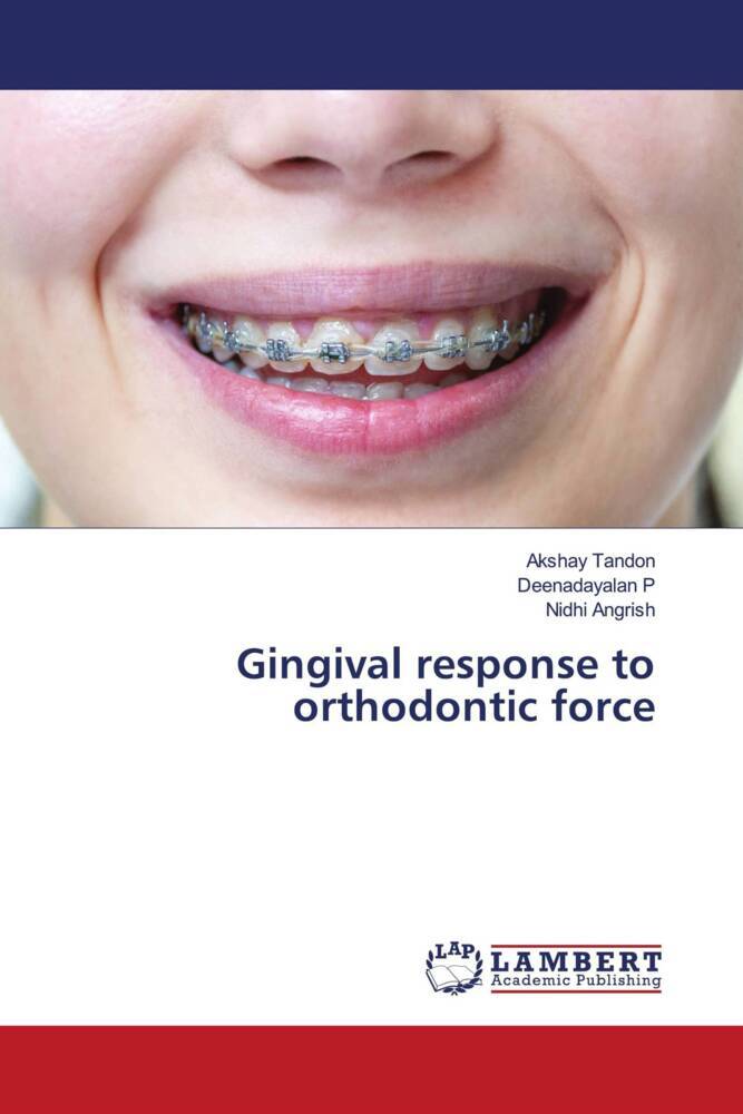 Gingival response to orthodontic force