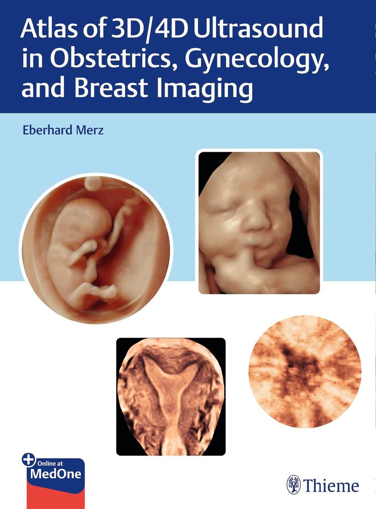 Atlas of 3D/4D Ultrasound in Obstetrics Gynecology and Breast Imaging