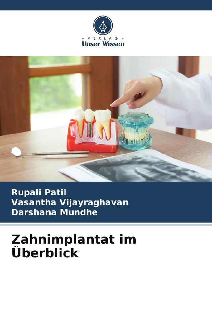 Zahnimplantat im Überblick
