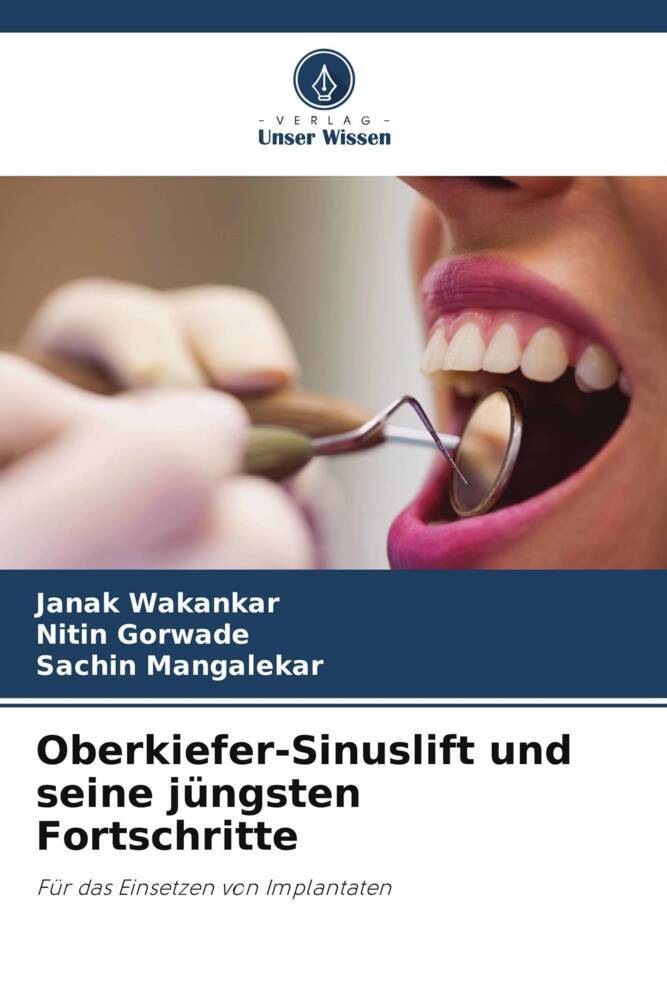 Oberkiefer-Sinuslift und seine jüngsten Fortschritte