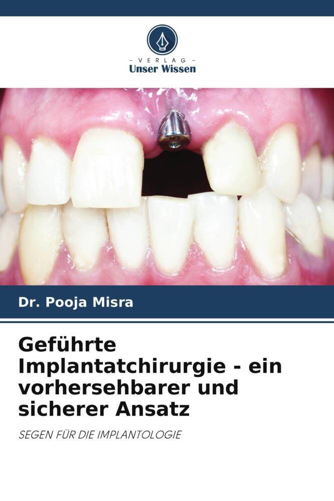 Geführte Implantatchirurgie - ein vorhersehbarer und sicherer Ansatz