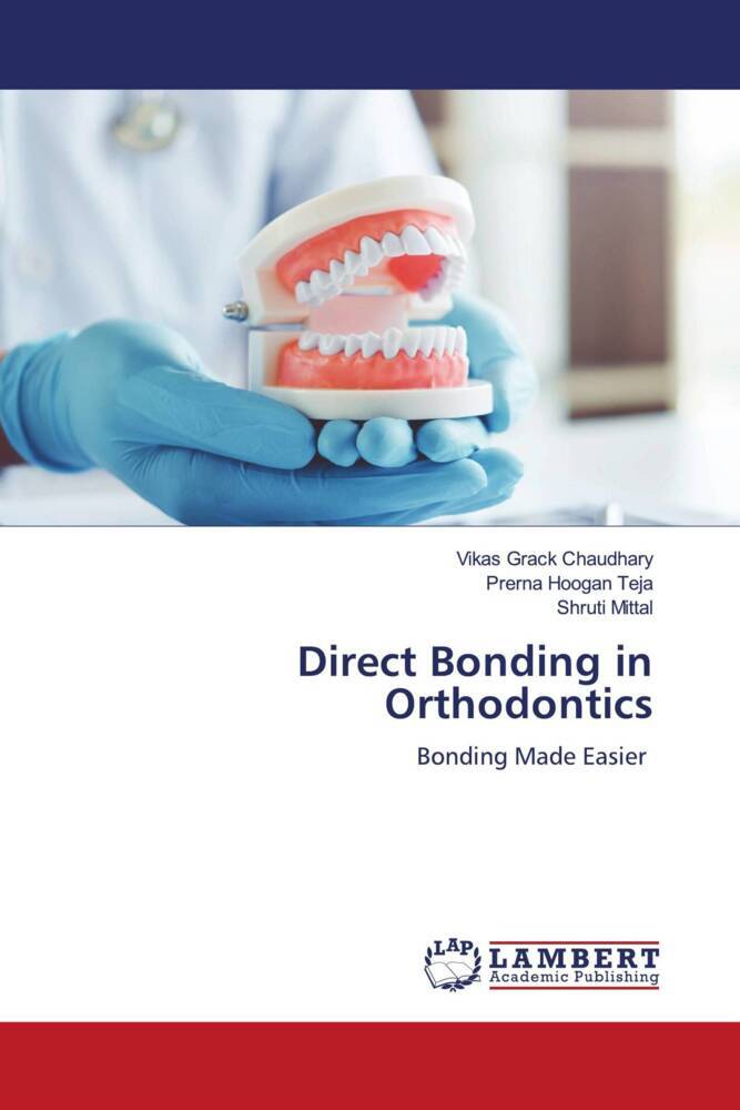 Direct Bonding in Orthodontics