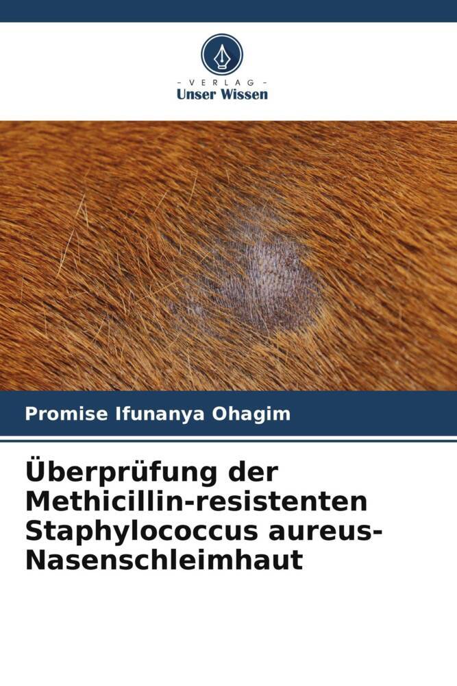 Überprüfung der Methicillin-resistenten Staphylococcus aureus-Nasenschleimhaut