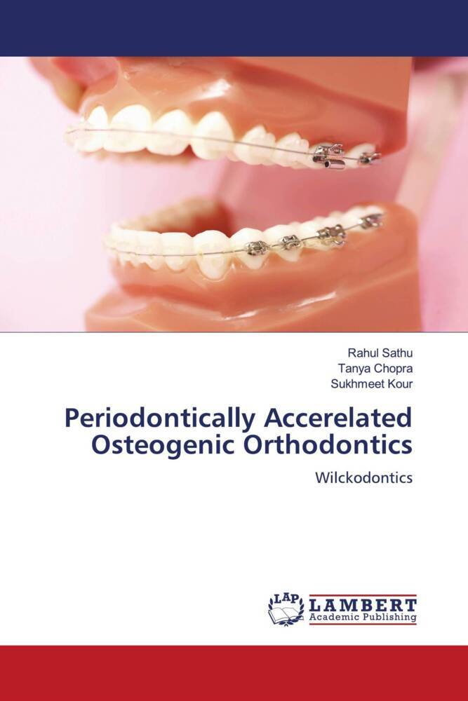 Periodontically Accerelated Osteogenic Orthodontics