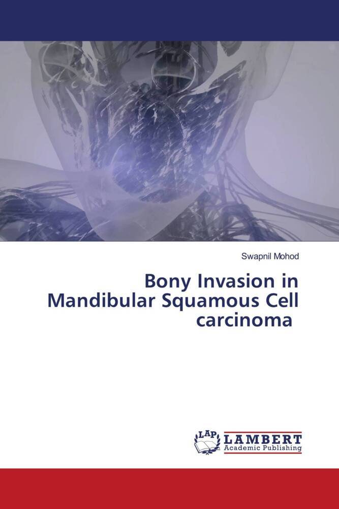 Bony Invasion in Mandibular Squamous Cell carcinoma