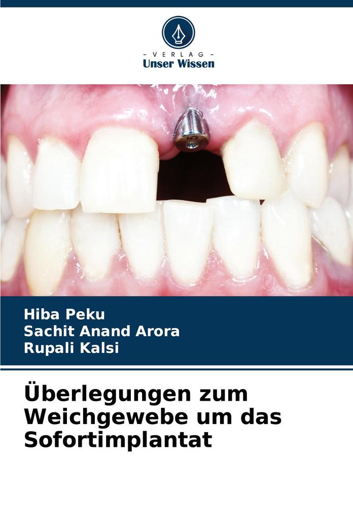 Überlegungen zum Weichgewebe um das Sofortimplantat