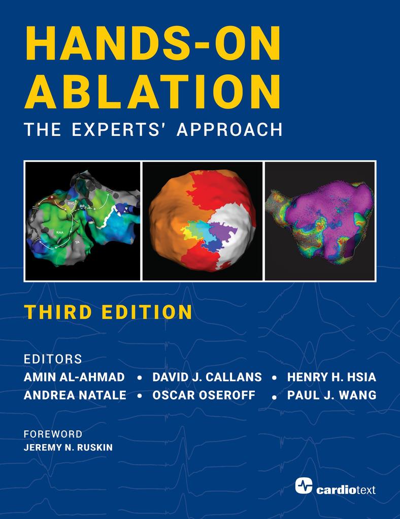 Hands-On Ablation The Experts' Approach Third Edition