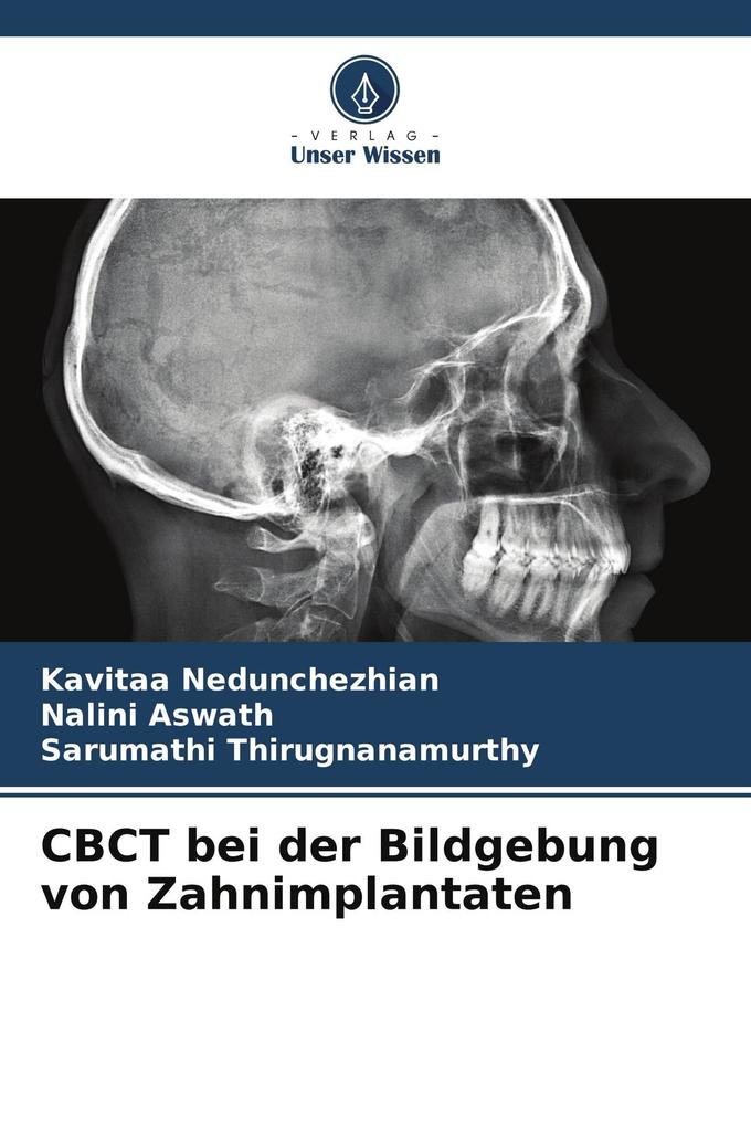 CBCT bei der Bildgebung von Zahnimplantaten