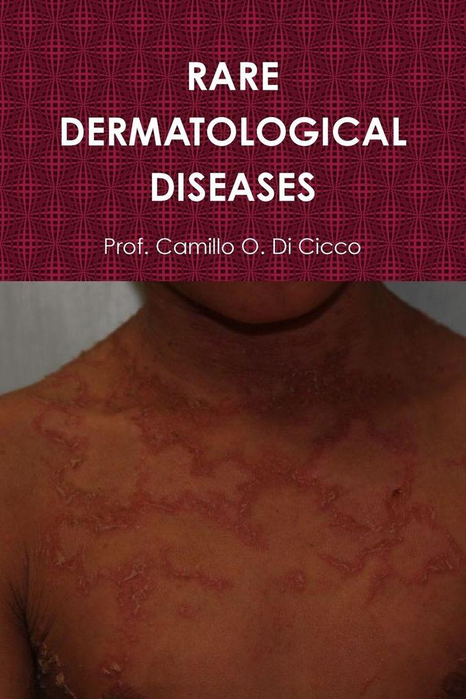RARE DERMATOLOGICAL DISEASES