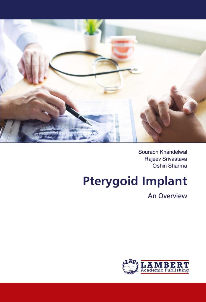 Pterygoid Implant