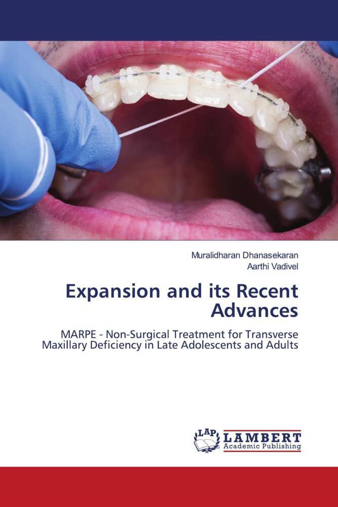 Expansion and its Recent Advances