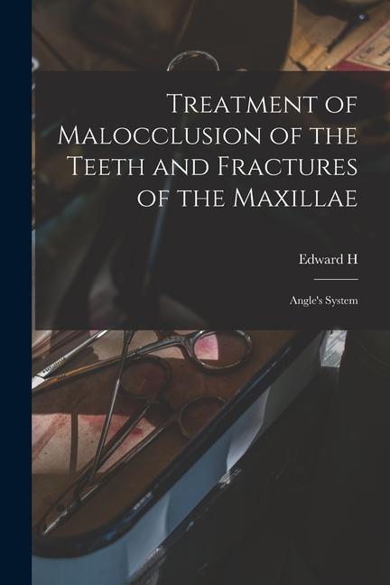Treatment of Malocclusion of the Teeth and Fractures of the Maxillae: Angle‘s System
