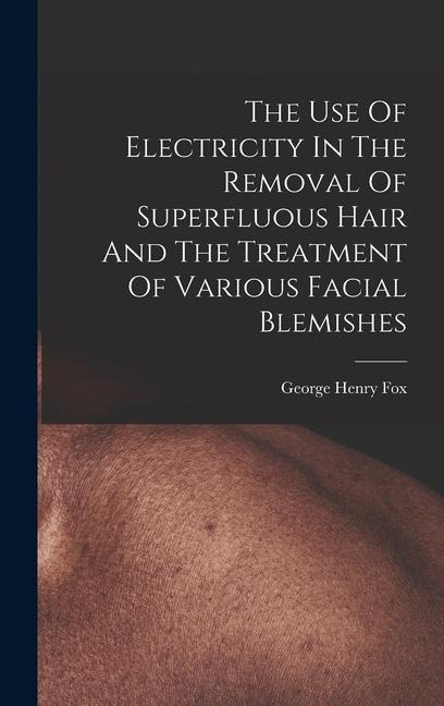 The Use Of Electricity In The Removal Of Superfluous Hair And The Treatment Of Various Facial Blemishes
