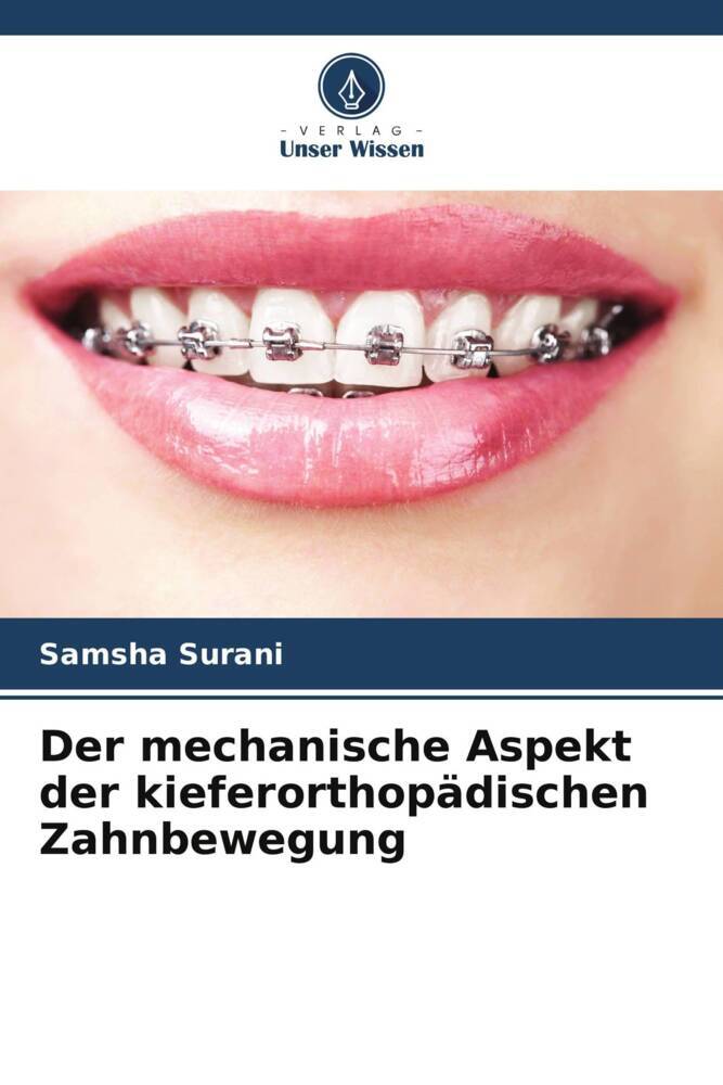 Der mechanische Aspekt der kieferorthopädischen Zahnbewegung
