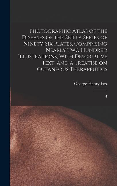Photographic Atlas of the Diseases of the Skin a Series of Ninety-six Plates Comprising Nearly two Hundred Illustrations With Descriptive Text and