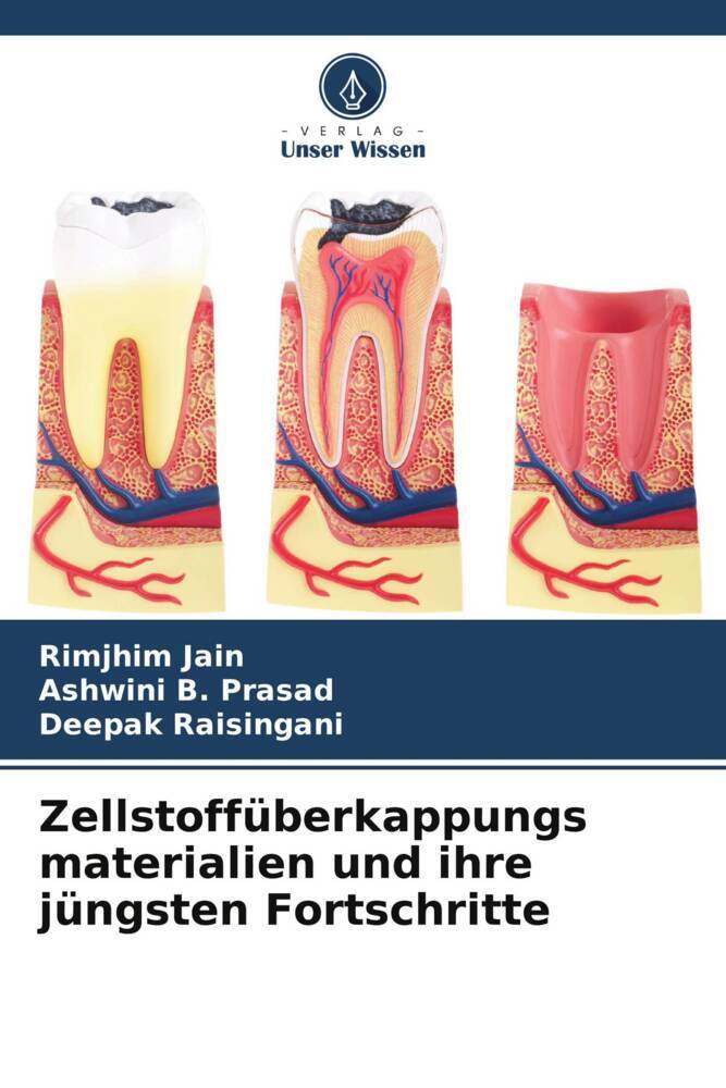 Zellstoffüberkappungs materialien und ihre jüngsten Fortschritte